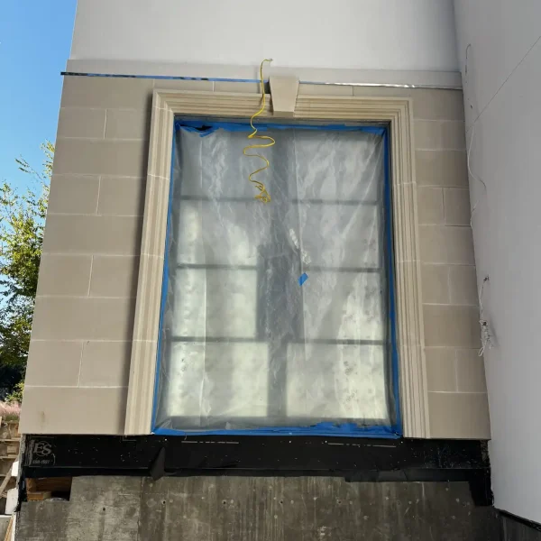 Banding and Veneers2